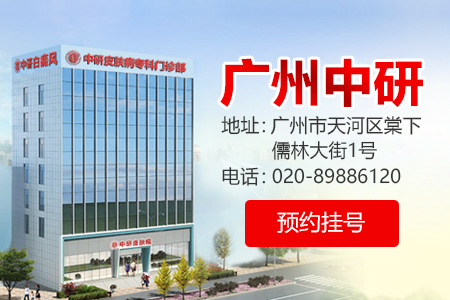 廣州白癜風醫院